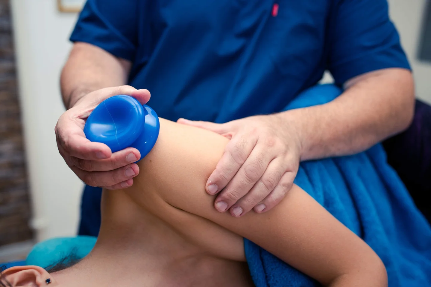 Boris using a silicone cup on a patient